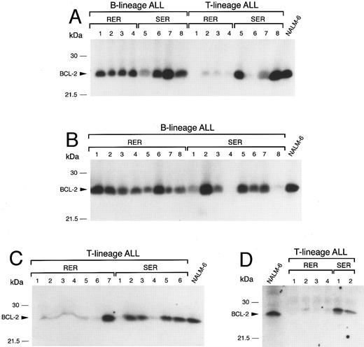 Fig. 3. Expression of BCL-2 in immunophenotypically distinct patient subsets according to treatment response. (A) BCL-2 expression in primary leukemic cells from eight B-lineage ALL and eight T-lineage ALL patients. In each subset, one half of the patients were rapid early responders (RER) and the other half slow early responders (SER). (B) BCL-2 expression in primary leukemic cells from 16 B-lineage ALL patients (eight RER and eight SER). (C) + (D) BCL-2 expression in 19 T-lineage ALL patients (11 RER, eight SER). In (A) through (D), NALM-6 cell lysates were used as internal standards.