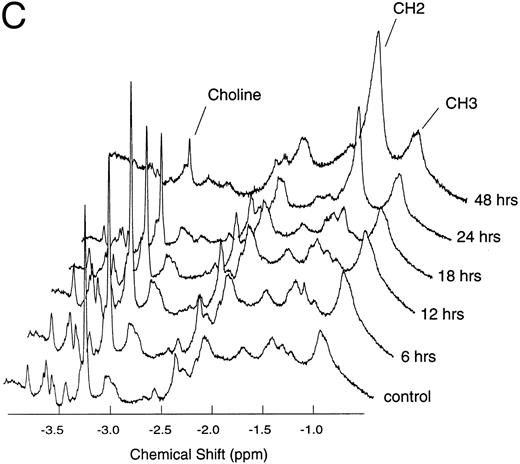 Fig. 1. Time course data of doxorubicin-treated Jurkat cultures. Jurkat cultures were incubated with 200 ng/mL of doxorubicin for 0, 6, 12, 18, 24, and 48 hours. (A) The percentage of apoptotic cells in culture as observed by nuclear morphologic analysis, FITC-annexin V flow cytometry, and DNA gel electrophoresis from 0 to 48 hours after doxorubicin treatment. (B) FITC-annexin V flow cytometric data from 0 to 24 hours after doxorubicin treatment. FCS, forward scatter; FITC-annexin V, fluorescent intensity at 494 nm plotted on a logarithmic scale. (C) 1H NMR spectra obtained (with 64 excitations) at 400 MHz. The spectral resonances of choline protons (-N(CH3 )) at 3.2 ppm, methylene protons (-CH2-) at 1.3 ppm, and methyl protons (-CH3 ) at 0.9 ppm are indicated. The CH2/CH3 signal intensity ratios were 0.28, 0.56, 0.33, 0.89, 2.41, and 4.42 at 0, 6, 12, 18, 24, and 48 hours after doxorubicin treatment, respectively.