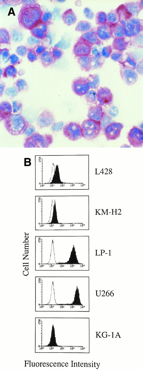 Fig. 2. (A) Hodgkin's disease-derived cell line L428. Cultured RS cells show staining for B-B4 antibody. Cytospin preparation; APAAP immunostaining; hematoxylin counterstain. (Original magnification × 400.) (B) Flow cytometry profiles showing B-B4 expression in human HD-derived cell lines (L428, KM-H2), myeloma cell lines (LP-1, U266), and myeloid leukemia cells KG-1A. Cells were incubated with the MoAb B-B4 (closed histograms) and an irrelevant isotype-matched mouse antibody (open histograms), followed by FITC-labeled goat antimouse Ig. The X and Y axes indicate the logarithm of the relative intensity of green fluorescence and relative cell numbers, respectively.