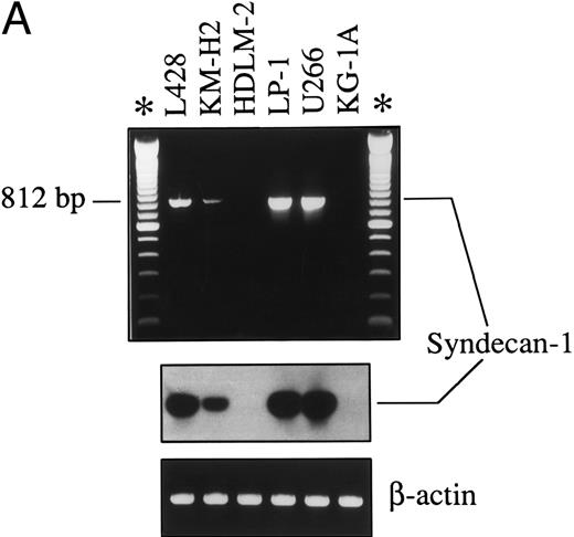 Fig. 3. (A) Expression of syndecan-1 mRNA in human HD-derived cell lines (L428, KM-H2, HDLM-2), myeloma cell lines (LP-1, U266), and myeloid leukemia cells KG-1A, as detected by RT-PCR. cDNA bulks were prepared and amplified with specific primers for human syndecan-1 (upper panel) or β-actin (lower panel). A total of 10 μL of amplified cDNAs was also run on 1.5% agarose gels, blotted onto nylon membranes, and hybridized with a syndecan-1–specific cDNA probe (center panel). (B) Western blot of cell lysates from the human myeloma cell line U266 (1.0 × 106 cells), the HD-derived cell line L428 (6.0 × 106 cells), and the myeloid leukemia cell line KG-1A (6.0 × 106 cells). The blot was incubated with 2.0 μg/mL of the MoAb B-B4 and shown by chemiluminescence. The position of the molecular weight markers is indicated.