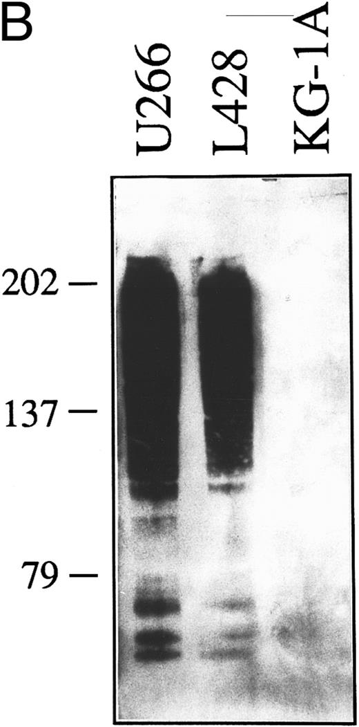 Fig. 3. (A) Expression of syndecan-1 mRNA in human HD-derived cell lines (L428, KM-H2, HDLM-2), myeloma cell lines (LP-1, U266), and myeloid leukemia cells KG-1A, as detected by RT-PCR. cDNA bulks were prepared and amplified with specific primers for human syndecan-1 (upper panel) or β-actin (lower panel). A total of 10 μL of amplified cDNAs was also run on 1.5% agarose gels, blotted onto nylon membranes, and hybridized with a syndecan-1–specific cDNA probe (center panel). (B) Western blot of cell lysates from the human myeloma cell line U266 (1.0 × 106 cells), the HD-derived cell line L428 (6.0 × 106 cells), and the myeloid leukemia cell line KG-1A (6.0 × 106 cells). The blot was incubated with 2.0 μg/mL of the MoAb B-B4 and shown by chemiluminescence. The position of the molecular weight markers is indicated.