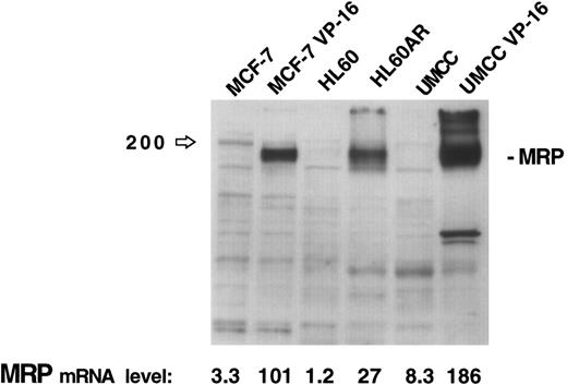 Fig. 2. MRP expression as measured by immunoblotting in three cell lines and their respective MRP-overexpressing sublines. MRP expression as measured by PCR assay for each cell line is noted at the bottom of the figure.