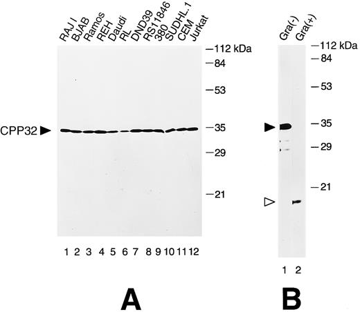 Fig. 1. Immunoblot analysis of CPP32 in lymphoid cell lines. (A) Cell lysates were prepared, normalized for total protein content (50 μg per lane), and subjected to SDS-PAGE/immunoblot assay using 0.1% (vol/vol) anti-CPP32 antiserum, followed by HRPase conjugated goat antirabbit secondary antibody and an ECL substrate.47 The position of the unprocessed 32-kD CPP32 protein is indicated. Reprobing the blot with an antibody against tubulin confirmed loading of essentially equivalent amount of total protein for all samples (not shown). (B) Recombinant CPP32 was treated (+) or not treated (−) with granzyme B and subjected to SDS-PAGE immunoblot analysis. The positions of the 32-kD pro-enzyme and 17-kD subunit of the processed CPP32 protease are indicated.
