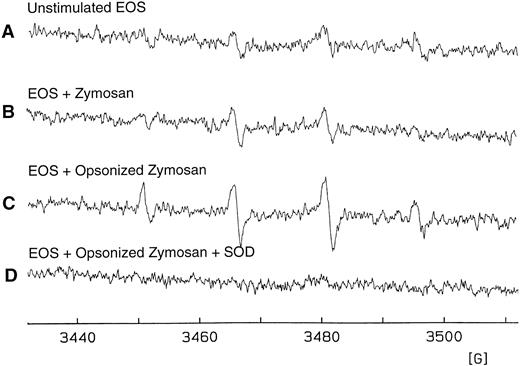 Fig. 6. Detection of eosinophil O−⋅2 production by the DMPO spin trapping technique. (A) EPR spectrum on isolated, unstimulated hepatic granuloma eosinophils (2 × 106 cells/mL) suspended in HBSS in the presence of DTPA (0.1 mmol/L) and DMPO (100 mmol/L) after 25 minutes of culture at 37°C. (B) EPR spectrum 25 minutes after addition of zymosan (1 mg/mL). (C) The same as (B) except in the presence of opsonized zymosan (1 mg/mL). (D) The same as (C) except in the presence of superoxide dismutase (CuZnSOD; 30 U/mL). Results are representative of five separate experiments. The spectra seen in tracings (A) through (C) are those of DMPO/⋅OH (AN = AH = 15.0 G).