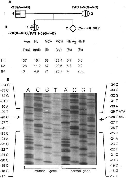 Fig. 2. Family II. (A) The hematologic profile and the β-thalassemia mutations characterized in the parents (I-1 and I-2) and their 6-year-old daughter (II-1). (B) Part of a sequencing gel showing the rare T → C mutation on the noncoding strand at position (−28) of the upstream ATA box in the father (I-1).