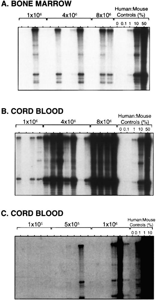 Fig. 1. Limiting dilution assays of adult BM and umbilical CB. (A) Southern blot analysis of human cell engraftment in the BM of mice transplanted with 1 to 8 × 106 BM cells. Mice were treated with alternate-day injections of human cytokines and killed 6 weeks posttransplant. Human:mouse DNA controls are given as percent human DNA. (B and C) Southern blot analysis of mice transplanted with 1 × 105 to 8 × 106 CB cells and killed after 6 weeks.