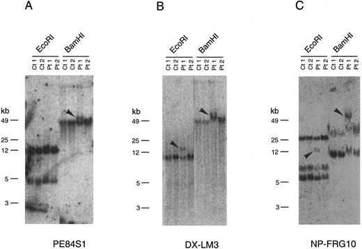 Fig. 2. Southern blot analysis of genomic DNA from two patients carrying the therapy-related inv(11). Genomic DNA samples from two inv(11) patients (Pt1, patient 1; Pt2, patient 2), as well as control cell lines (Ct1, Namalwa; Ct2, C498) were digested with EcoRI or BamHI. Rearranged bands are indicated by arrowheads. Hybridization of three probes, PE84S1 (A), DX-LM3 (B), and NP-FRG10 (C), is shown. kb, kilobases.