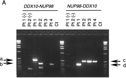 Fig. 3. RT-PCR analysis of the DDX10-NUP98 and NUP98-DDX10 chimeric transcripts in four inv(11) patients with de novo or secondary myeloid malignancies. (A) Detection of RT-PCR products by electrophoresis. The DDX10-NUP98 and NUP98-DDX10 chimeric transcripts were amplified with primers DF26 and NR17, and primers NF2 and DR27, respectively (see Fig 1C and D). Pt1, Pt2, Pt3, Pt4: RT-PCR amplified patient RNA samples. Pt1 (−), Pt2 (−): patient 1 and 2 PCR product without reverse transcription. Ct: RT-PCR amplified normal peripheral blood RNA. Arrows indicate the detected fusion transcripts. (B) Sequences of the junctions of the NUP98-DDX10 chimeric transcripts (DDBJ/EMBL/GenBank accession nos. AB000267 and AB000268). Two RT-PCR products (c and d) were sequenced. Nucleotide sequences and predicted amino acid sequences around the junctions are shown. The vertical arrows indicate the junction points of the two genes.
