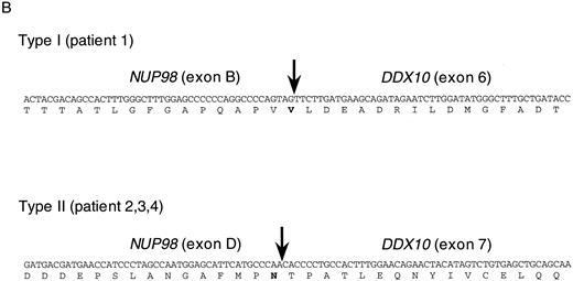 Fig. 3. RT-PCR analysis of the DDX10-NUP98 and NUP98-DDX10 chimeric transcripts in four inv(11) patients with de novo or secondary myeloid malignancies. (A) Detection of RT-PCR products by electrophoresis. The DDX10-NUP98 and NUP98-DDX10 chimeric transcripts were amplified with primers DF26 and NR17, and primers NF2 and DR27, respectively (see Fig 1C and D). Pt1, Pt2, Pt3, Pt4: RT-PCR amplified patient RNA samples. Pt1 (−), Pt2 (−): patient 1 and 2 PCR product without reverse transcription. Ct: RT-PCR amplified normal peripheral blood RNA. Arrows indicate the detected fusion transcripts. (B) Sequences of the junctions of the NUP98-DDX10 chimeric transcripts (DDBJ/EMBL/GenBank accession nos. AB000267 and AB000268). Two RT-PCR products (c and d) were sequenced. Nucleotide sequences and predicted amino acid sequences around the junctions are shown. The vertical arrows indicate the junction points of the two genes.