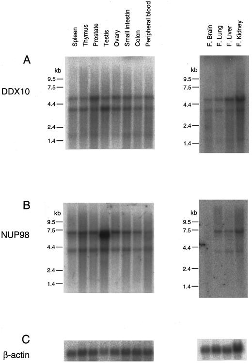 Fig. 5. Northern blot analysis of the expression of DDX10 and NUP98 genes in human tissues. Northern blot filters from human adult and fetal tissues (Clontech) were used for analysis. Probes: (A), DX-FRG116 (nucleotides 21 to 1347 of DDX10 cDNA18 ); (B), NP-FRG123 (nucleotides 93 to 2655 of NUP98 cDNA21 ); (C), β-actin. kb, kilobases.