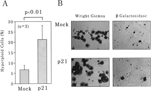 Fig. 7. Overexpression of p21-induced polyploidization of UT-7 cells. pcDNA3 expression plasmid containing full-length p21 cDNA was introduced into UT-7 cells by electroporation. pSV-β-gal vector was simultaneously transfected to monitor the transfection efficiencies. As a control, empty pcDNA3 vector was transfected in the same manner (Mock). The cells were harvested after 3 days of the culture. (A) The percentage of polyploid cells was determined as described in the legend to Fig 1. The mean ± SD (bar) of three independent experiments is shown. (B) Wright-Giemsa staining of Mock- and p21-transfected cells is shown in the left panel. The result of in situ detection of β-galactosidase activity is shown in the right panel. (Original magnification × 400 and × 250, respectively).