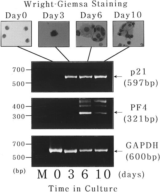 Fig. 9. Expression of p21waf1/cip1 and PF4 mRNA during short-term liquid culture of normal human megakaryocytes. Short-term liquid culture of normal human megakaryocytes was performed as described.1718 The cells were harvested at the indicated time points and subjected to morphologic examination on Wright-Giemsa–staining cytospin slides (upper panel) and semiquantitative RT-PCR analysis for p21, PF4, and GAPDH mRNA expression (lower panel). The numbers of PCR cycles were set in each gene to show that the amount of amplified PCR product was directly proportional to the amount of input RNA (35 cycles for each gene). Amplified products were analyzed on 2% agarose gels followed by ethidium bromide staining. M, molecular size marker (BioMarker Low; Bio Ventures, Inc, Murfreesboro, TN).
