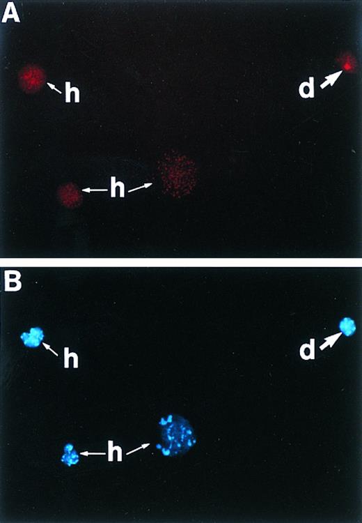 Fig. 2. A cytospin of pooled marrow from mice transplanted with 10,000 Rh/Hoedull cells and resorted for cells with the same Rh/Hoedull characteristics of the cells initially seeded. (A) Cells are stained using in situ hybridization for a digoxigenin-conjugated Y chromosome-specific “painting” probe and visualized with rhodamine using a 590-nm longpass filter. Positive cell (d) is of donor origin, while unlabeled cells (h) are of host origin. (B) Same as (A) except counterstained with DAPI, excited with UV, and visualized using a 450-nm longpass filter. Original magnification (OM) × 313.