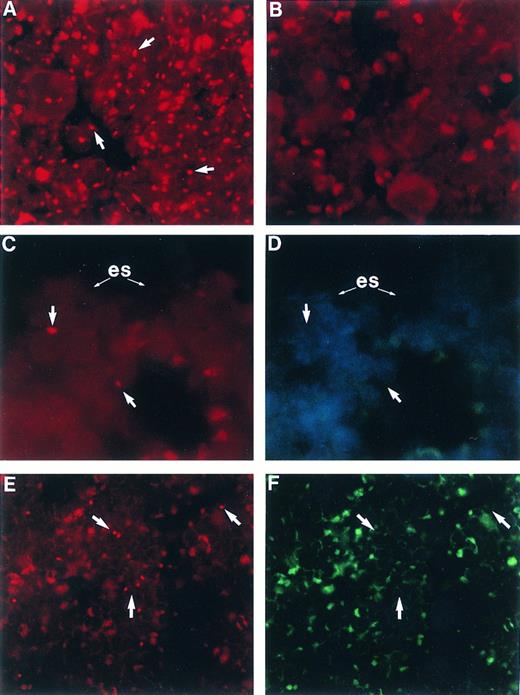 Fig. 3. Femoral BM sections from BALB/c mice: (A) male, (B) female, (C) female 6 weeks posttransplant with 2,500 Rh/Hoedull marrow cells, and (E) female 6 weeks posttransplant with 100 × 106 whole marrow cells. Sections are stained using in situ hybridization for a digoxigenin-conjugated Y chromosome-specific “painting” probe and rhodamine anti-digoxigenin (arrows) and visualized using a 590-nm longpass filter. (D) and (F ) same as (C) and (E), respectively, except counterstained with DAPI, excited with UV, and visualized using a 450-nm longpass filter. Arrows point to corresponding Y chromosome-positive cells. (es) Endosteal surface; the actual bone is removed during the denaturing step of the in situ hybridization. Sections are mounted in Vectashield antifade. OM × 746 (A through D); OM × 500 (E and F ).