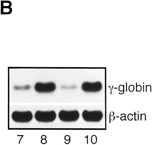 Fig. 11. Reversible changes in the EPO-induced erythroid differentiation. UT-7/GM cells (lanes 1 and 7) were exposed to EPO (10 U/mL) for 4 weeks (lanes 2 and 8) and sequentially cultured with GM-CSF (10 ng/mL) alone for 1 week (lane 3) or 2 weeks (lanes 4 and 9). Then, the cells were obtained and prepared for the detection of hemoglobin synthesis, and the rest were sequentially cultured with EPO (10 U/mL) alone for 1 week (lane 5) or 2 weeks (lanes 6 and 10) and harvested. (A) Dianisidine-staining. (B) Northern blot analysis of γ-globin gene. The membrane was rehybridized with 32P-labeled β-actin cDNA probe to show the amount of RNA loaded.