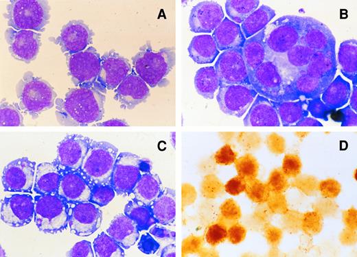 Fig. 3. Morphological characteristics of UT-7/GM cells in liquid culture. Cytospin smears of May-Giemsa–stained UT-7/GM cells cultured with GM-CSF (A; original magnification × 400), TPO (B; original magnification × 400), or EPO (C; original magnification × 400), and dianisidine-stained UT-7/GM cells shown in C (D; original magnification × 250). UT-7/GM cells were cultured with GM-CSF (10 ng/mL), TPO (100 ng/mL), or EPO (10 U/mL). One month later, the cells were obtained for the preparation of cytospin smears.