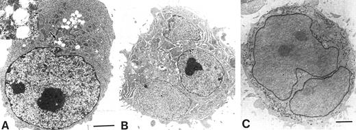 Fig. 4. Electron microscopic photographs of UT-7/GM cells cultured under various conditions. UT-7/GM cells were cultured with EPO (10 U/mL) or TPO (100 ng/mL). One month later, the cells were obtained for the analysis. (A) A representative UT-7/GM cell cultured with EPO. The cytoplasm of the cell is darker than the nucleus, implying the presence of hemoglobin. Insert shows higher magnification of atypical theta granules (arrow). Counterstaining was performed with lead citrate and uranyl acetate. Scale marker indicates 2 μm. (B) A representative UT-7/GM cell cultured with TPO. A multinucleated cell having developed demarcation membrane systems is shown. (C) Detection of PPO activity in a cell cultured with TPO. PPO activity is observed in nuclear envelope and rough endoplasmic reticulum of a large binuclear cell. Scale marker indicates 2 μm.