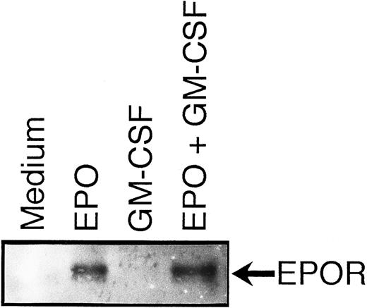 Fig. 8. Suppression by GM-CSF of EPO-induced erythroid differentiation occurs downstream of the EPO receptor. GM-CSF was removed from UT-7/GM cells overnight. The cells were pretreated with medium alone (lanes 1 and 2) or GM-CSF (10 ng/mL; lanes 3 and 4) for 5 minutes and then stimulated with medium alone (lanes 1 and 3) or EPO (10 U/mL; lanes 2 and 4) for 5 minutes before solubilization. Cell lysates were immunoprecipitated with agarose-conjugated anti-EPOR antibody. Immunoprecipitates were eluted with buffer containing SDS and resolved by 7.5% SDS-PAGE. Proteins were transferred onto a nitrocellulose membrane and blotted with anti-P-Tyr MoAb (4G10).