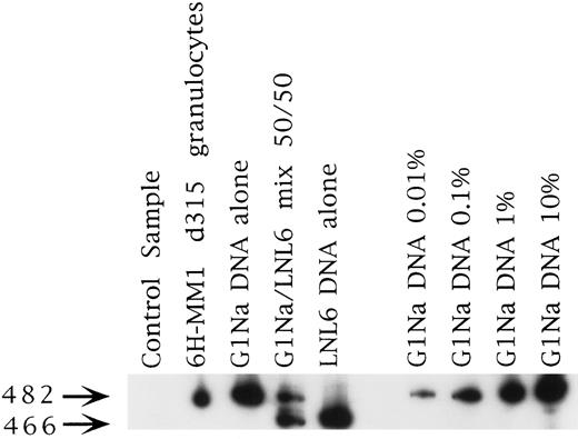 Fig. 2. Representative PCR sample from patient 6H-MM1. This was the longest marking observed in any patient at 315 days. The signal strength is about 0.1% and is from the fraction marked with the G1Na vector, which was used to mark the PB fraction in this case (see Table 1).