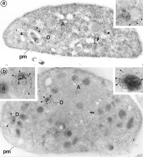 Fig. 1. (a) Platelets treated for the cytochemical detection of dense granules by the uranaffin technique of Richards and Da Prada10 and then immunolabeled for Gp Ib (polyclonal anti-Gp Ib/GAR 10 nm). The gold label lines the plasma membrane (pm) and is occasionally found on α-granules (A). Moreover, a granule with a dense content (D) is also labeled for Gp Ib. (Original magnification × 40,000.) (Inset) High magnification of a dense granule displaying immunolabeling for Gp Ib. (Original magnification × 59,000.) (b) Platelets pretreated by the uranaffin technique of Richards and Da Prada,10 embedded in GMA, and then immunolabeled for Gp IIb-IIIa (polyclonal anti–Gp IIb-IIIa/GAR 10 nm). Gold label is evident along the plasma membrane (pm) as well as along the α-granules (A). Note that the limiting membrane of the two dense granules (D) is also strongly labeled. (Original magnification × 32,000.) (Insets) High magnification of dense granules labeled for Gp IIb-IIIa. (Original magnification × 59,000 and × 92,000.)