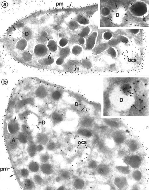 Fig. 3. Detection of Gp Ib in dense granules by double immunolabeling on frozen thin sections of platelets. (a) P-selectin (polyclonal anti–P-selectin/protein A 10 nm; arrowheads)/Gp Ib (polyclonal anti–Gp Ib/protein A 15 nm; arrows). P-selectin is present in the α-granules (A) and dense granules (D). Gp Ib is evident along the plasma membrane (pm), occasional OCS, and α-granules. The dense granule membrane (D) that is marked with P-selectin also contains gold marker for Gp Ib. (Original magnification × 46,500; inset, × 101,000.) (b) Granulophysin (monoclonal anti-granulophysin/GAM 10 nm; arrowheads)/Gp Ib (polyclonal anti–Gp Ib/protein A 15 nm; arrows). Granulophysin labels the dense granule membrane (D) but not the α-granules (A). Gp Ib is found essentially along the plasma membrane (pm). The OCS and some α-granules (A) are occasionaly labeled. It also double-labels the dense granule membrane (D) identified by the presence of granulophysin. (Original magnification × 46,500; inset, × 84,000.)