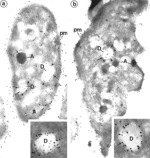 Fig. 4. Detection of Gp IIb-IIIa on dense granules by double immunolabeling performed on frozen thin sections of platelets. (a) P-selectin (polyclonal anti–P-selectin/protein A 10 nm; arrowheads)/Gp IIb-IIIa (polyclonal anti–Gp IIb-IIIa/protein A 15 nm; arrows). The presence of P-selectin identifies α-granules (A) and the dense granule membrane (D). Gp IIb-IIIa lines the plasma membrane (pm) and the α-granule membrane (A). Note that it is present in the dense granule membrane (D), where it colocalizes with P-selectin. (Original magnification × 36, 000; inset, × 84,000.) (b) Granulophysin (monoclonal anti-granulophysin/GAM 10 nm; arrowheads)/Gp IIb-IIIa (polyclonal anti–Gp IIb-IIIa/protein A 15 nm; arrows). The anti-granulophysin labels the dense granule membrane, thus allowing identification of these structures (D). Gp IIb-IIIa is also found at their level. Gp IIb-IIIa labels the α-granule membrane (A) and the plasma membrane (pm) as well. (Original magnification × 44,000; inset, × 84,000.)