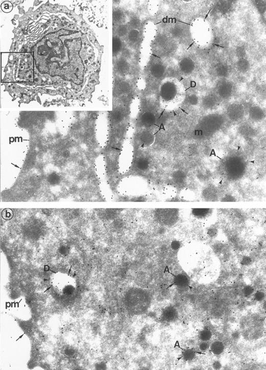 Fig. 5. Human MK double-labeled for the α-granule and dense granule marker P-selectin, combined with Gp Ib or Gp Iib-IIIa. (Inset) Human cultured MK are large in size and have an indented nucleus, numerous secretory granules, and a prominent demarcation membrane system. (Original magnification × 16,000.) (a) P-selectin (polyclonal anti–P-selectin/protein A 10 nm; arrowheads)/Gp Ib (polyclonal anti–Gp Ib/protein A 15 nm; arrows). P-selectin lines the α-granules (A) and the dense granule membrane (D) and is absent from the plasma membrane (pm) and demarcation membranes (dm). In contrast, Gp Ib lines the plasma membrane and demarcation membranes (dm). Gp Ib is also found within the dense granule membrane (D) colocalized with P-selectin. Mitochondria (m), as control structures, do not label. (Original magnification × 72,000.) (b) P-selectin (polyclonal anti–P-selectin/protein A 10 nm; arrowheads)/Gp IIb-IIIa (polyclonal anti–Gp IIb-IIIa/protein A 15 nm; arrows). Gp IIb-IIIa is classically located on the plasma membrane (pm) and α-granules (A). It also colocalizes with P-selectin in the α-granules and, noteworthily, within the dense granules (D). (Original magnification × 33,500.)