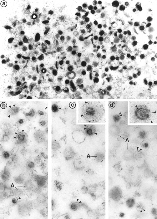 Fig. 6. (a) Electron microscopic examination of the dense granule fraction whose electron density has been enhanced by White's cytochemical technique. This shows the high purity of the fraction that is almost exclusively composed of dense bodies. Only few membranes and platelet granules of other types can be identified. (Original magnification × 18,500.) (b, c, and d) Immunolabeling of the dense granule fraction pretreated by the uranaffin technique of Richards and Da Prada10 and embedded in GMA. (b) Labeling of P-selectin (polyclonal anti–P-selectin/GAR 10 nm). P-selectin is present in the membrane of α-granules (A) and in some of the dense granules (D) that are still identifiable, but only discrete labeling is obtained. This might be caused by the interaction of the chemical solutions with the antigenic sites, which could have decreased their reactivity. (Original magnification × 38,500.) (c) Immunolabeling for Gp IIb-IIIa (polyclonal anti–Gp IIb-IIIa/GAR 10 nm) is similar to immunolabeling for P-selectin and is present in the membrane of some dense granules (D) as well as α-granules (A). (Original magnification × 38,500; inset, × 100,500.) (d) Immunolabeling for Gp Ib (polyclonal anti–Gp Ib/GAR 10 nm) is occasionaly found in the membrane of dense granules (D). α-Granules (A) present in this field are not labeled. (Original magnification × 38,500; inset, × 74,500.)