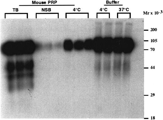 Fig. 1. Autoradiograph showing the in vitro binding and degradation of 125I-rmTPO by platelets. Mouse PRP was incubated with 125I-rmTPO (TB) or 125I-rmTPO + 10 μg rmTPO (NSB) at 37°C, or with 125I-rmTPO alone at 4°C for 1 hour. 125I-rmTPO was also incubated with buffer at 4°C or 37°C. Samples were then analyzed by SDS-PAGE. Approximate MW were determined from MW standards run on the same gel.