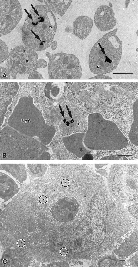 Fig. 7. Electron microscopy autoradiographs showing cellular localization of 125I-rmTPO within platelets, spleen, and sternum. Mice received a single IV bolus injection of 125I-rmTPO and were killed 3 hours later. Sections of platelets, spleen, and sternum were fixed and processed for electron microscopy. Silver grains were found associated with platelets in (A) PRP and (B) spleen, and (C) megakaryocytes in sternum. The bar in the autoradiographs is equal to 1 μm.