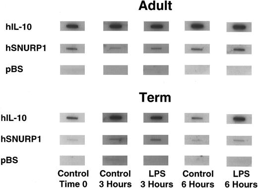 Fig. 2. Nuclear run-on transcription assay demonstrating IL-10 transcription rate in adult (upper panel) and term neonatal blood PBMNCs (lower panel) at the time of isolation (time 0), following 3 and 6 hours in culture without LPS stimulation (control 3 hours and control 6 hours), and following stimulation with 10 μg/mL LPS (LPS 3 hours and LPS 6 hours). The IL-10 target is a 1.8-kb Xho I cDNA insert, SNURP1 is shown as an internal control, and bluescript (pBS) is shown as the negative control.