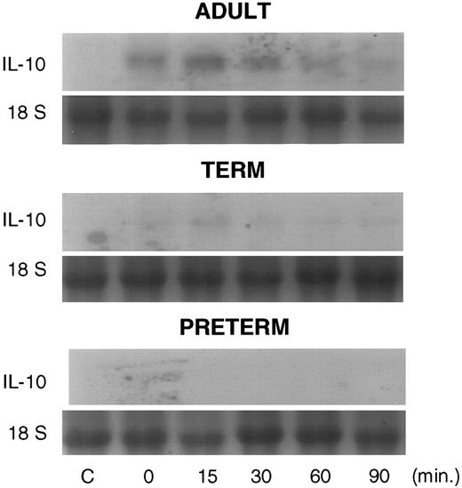 Fig. 4. Northern blot analysis probed with a 760-bp fragment of the IL-10 cDNA demonstrating IL-10 transcript content of PBMNCs from adult (upper panel), term (middle panel), and preterm blood (lower panel) in the absence of LPS (C, lane 1) and cultured for 10 hours with LPS (1 μg/mL), then treated with actinomycin D (10 μg/mL) at time 0, 15, 30, 60, and 90 minutes (lanes 2-6, respectively). RNA loading is standardized using 18S ribosomal RNA bands.
