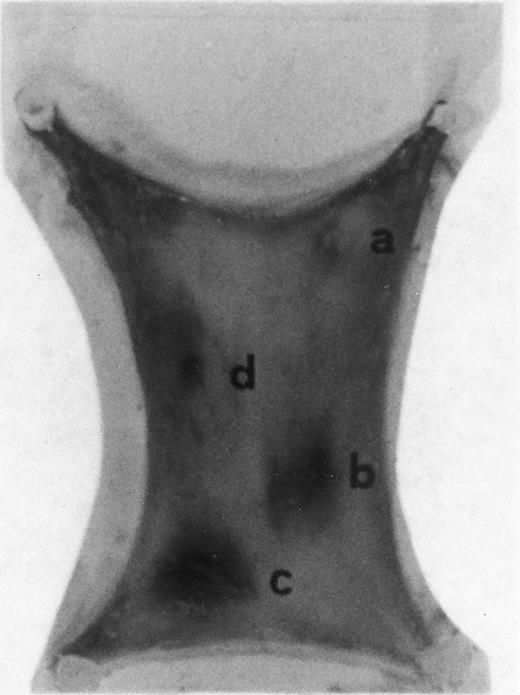 Fig. 1. Evan's blue-stained intradermal injection sites showing the kinetics of the dermal response to exogenous human RANTES 10 ng/50 μL (c) and MCP-1 10 ng/50 μL (d); while (a) is a negative control (PBS 50 μL) and (b) is a positive control (FMLP 10−6 mol/L in 50 μL). This representative experiment was found to be reproducible and has been performed at least three times.
