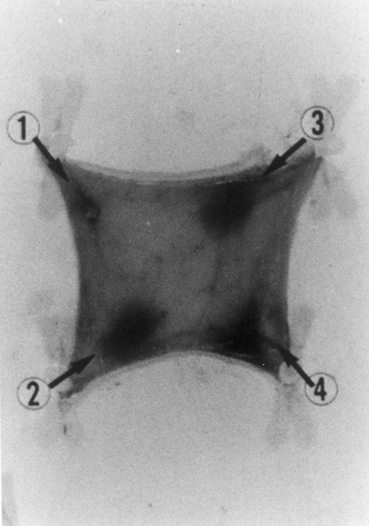 Fig. 2. Evan's blue-stained intradermal injection sites showing the kinetics of the dermal inflammatory response to exogenous human recombinant RANTES 20 ng/50 μL (no. 2) and 10 ng/50 μL (no. 3); while PBS 50 μL was a negative control (no. 1) and LPS 10 ng/50 μL is a positive control (no. 4). This representative experiment was found to be reproducible and has been performed at least three times.