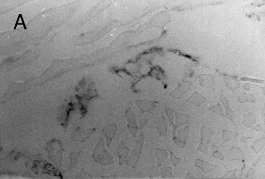 Fig. 3. Basophilic cell migration induced by human recombinant RANTES 10 ng (C) and MCP-1 10 ng (D) into sites of injection. The sections were stained with Toluidine blue (0.1%) and analyzed at a magnification of ×40 (Nikon Diaphore). (A) represents a control and (B) is a positive control where FMLP was used at 10−6 mol/L. This representative experiment was found to be reproducible and has been performed at least three times.