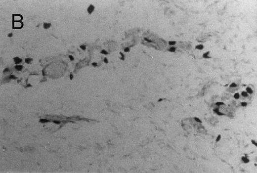 Fig. 3. Basophilic cell migration induced by human recombinant RANTES 10 ng (C) and MCP-1 10 ng (D) into sites of injection. The sections were stained with Toluidine blue (0.1%) and analyzed at a magnification of ×40 (Nikon Diaphore). (A) represents a control and (B) is a positive control where FMLP was used at 10−6 mol/L. This representative experiment was found to be reproducible and has been performed at least three times.
