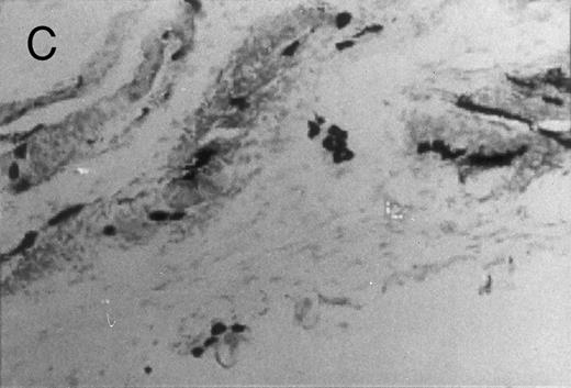 Fig. 3. Basophilic cell migration induced by human recombinant RANTES 10 ng (C) and MCP-1 10 ng (D) into sites of injection. The sections were stained with Toluidine blue (0.1%) and analyzed at a magnification of ×40 (Nikon Diaphore). (A) represents a control and (B) is a positive control where FMLP was used at 10−6 mol/L. This representative experiment was found to be reproducible and has been performed at least three times.