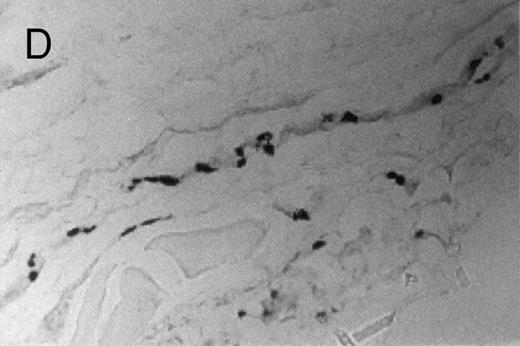 Fig. 3. Basophilic cell migration induced by human recombinant RANTES 10 ng (C) and MCP-1 10 ng (D) into sites of injection. The sections were stained with Toluidine blue (0.1%) and analyzed at a magnification of ×40 (Nikon Diaphore). (A) represents a control and (B) is a positive control where FMLP was used at 10−6 mol/L. This representative experiment was found to be reproducible and has been performed at least three times.