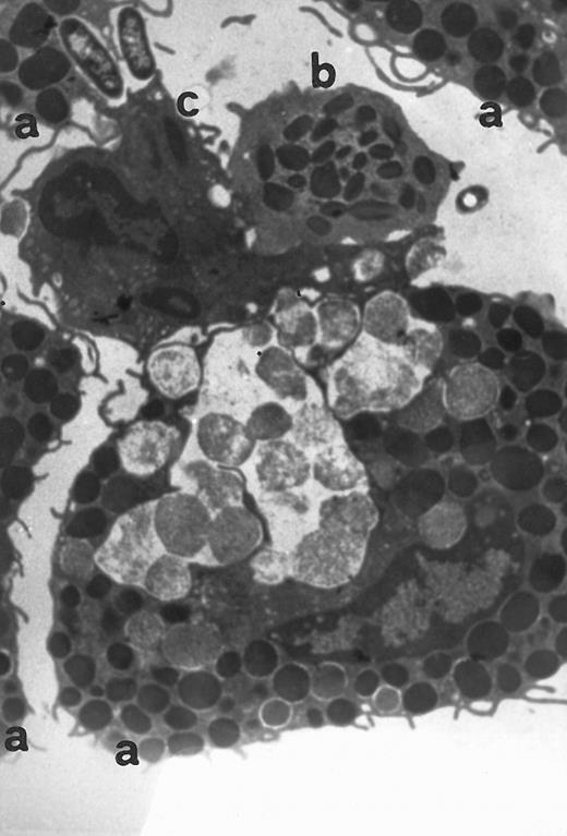 Fig. 4. Transmission electromicrography of a representative experiment of rat inflamed injection site produced by RANTES 10 ng. The section showing the kinetics of the dermal response to exogenous RANTES 4 hours after injection. Evidence for intravascular activation of basophilic cells (a), eosinophil (b), and macrophage (c). Original magnification × 13,800.