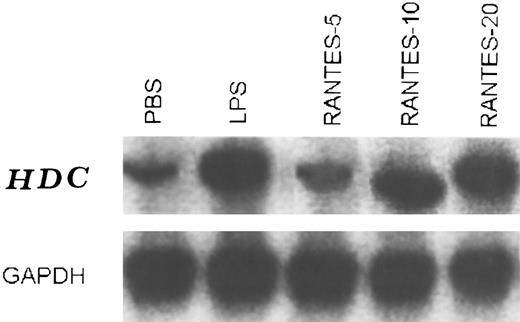 Fig. 5. Steady-state levels of HDC mRNA in the intradermal injection site tissue in the presence of RANTES (5, 10, and 20 ng/50 μL) lane 2, 3, and 4, respectively, and PBS (control) lane 1, and LPS 20 ng/50 μL (lane 5) after 4 hours of treatments. This is a representative experiment of four.