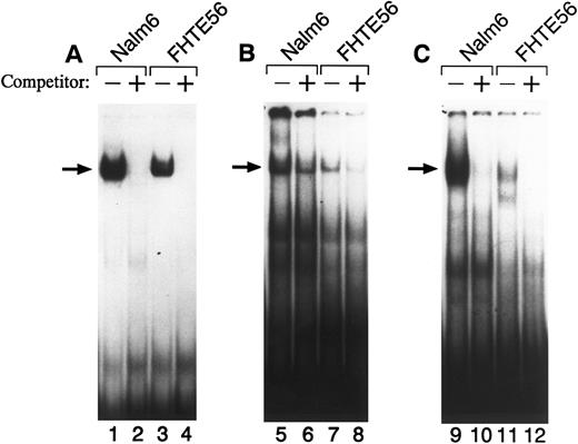 Fig. 3. EMSA of the type 2 CD10/NEP promoter with wild-type region I (A), II (B), or III (C) probes. Double-stranded oligonucleotides from regions I, II, or III were 32P-labeled and incubated with 5 μg nuclear protein from Nalm-6 (lanes 1, 2, 5, 6, 9, and 10) or FHTE56 (lanes 3, 4, 7, 8, 11, and 12) in the absence (−) or presence (+) of 100-fold molar excess unlabeled self-oligonucleotide. Arrows identify the major shifted bands.