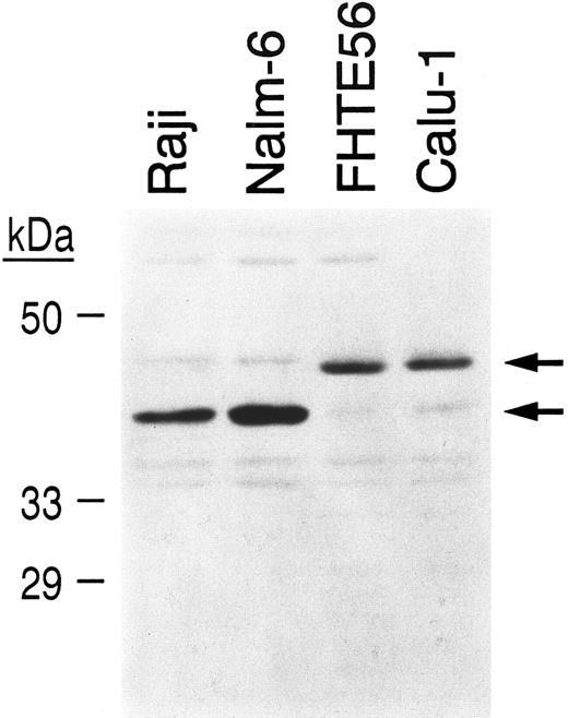 Fig. 7. Detection of alternatively spliced CBF-B/NF-YA subunits in lymphoid and epithelial cell extracts. Nuclear extracts from Raji and Nalm-6 lymphoid cells and FHTE56 and Calu-1 epithelial cells were size-fractionated, blotted, and incubated with an affinity-purified antiserum directed against the C-terminal peptide of NF-YA.35 The ∼40-kD CBF-B/NF-YA short form and the ∼43-kD CBF-B/NF-YA long form are indicated.