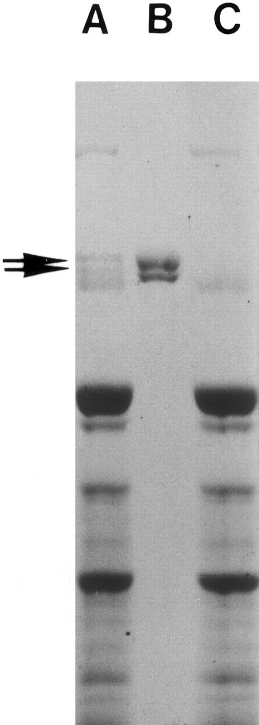 Fig. 1. Fibronectin preparation. Human whole plasma was passed through gelatin-Sepharose column three times, and fibronectin eluted from the column as described in Materials and Methods. SDS-PAGE of adult human plasma (A), purified plasma fibronectin (10 μg, B), and fibronectin-depleted adult human plasma (C) is shown. The gel was then stained with Coomassie blue. Note the missing fibronectin doublet in lane C and that no other protein bands are missing.
