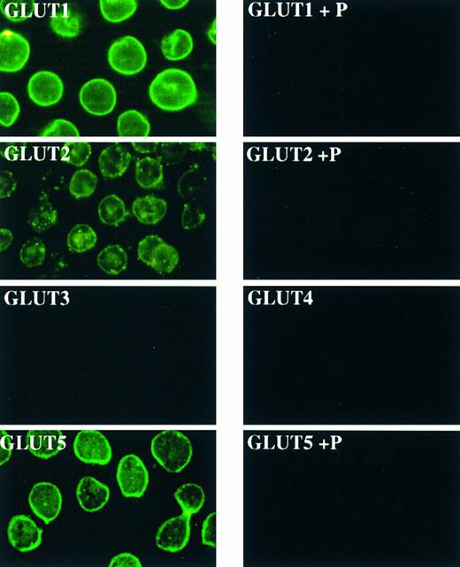 Fig. 1. The fructose transporter GLUT5 is expressed in human erythrocytes. For immunofluorescence, erythrocyte smears were reacted with GLUT antibodies or with antibodies preabsorbed with the corresponding peptide (P) and visualized using fluorescein-coupled secondary antibodies.