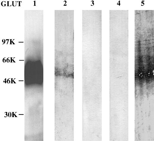 Fig. 3. Expression of hexose transport proteins in erythrocytes. For immunoblotting, total erythrocyte membrane proteins were loaded on each lane of a sodium dodecyl sulfate-containing polyacrylamide gel, electrophoresed, transferred to Immobilon, reacted with the different anti-GLUT antibodies, and visualized using horseradish peroxidase antirabbit IgG and enhanced chemiluminescence. Sizes on the left are kD.