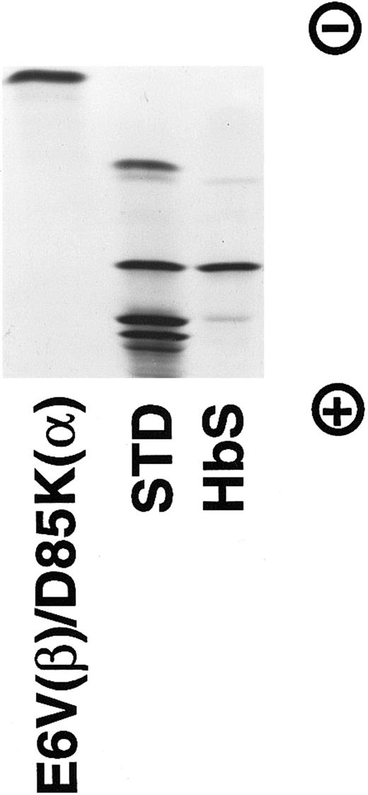 Fig. 2. Isoelectric focusing of the purified E6V(β)/D85K(α) Hb. A gel from Isolab (pH 6-8) containing about 30 μg of protein was electrophoresed at 10 W for 45 minutes and stained by bromophenol blue. The standard contains (from top to bottom): HbC, HbS, HbF, and HbA.