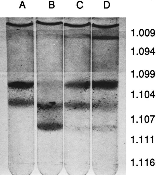 Fig. 1. Percoll density-gradient centrifugation of blood. (A) MHOAH, (B) M-Tg98Ru, (C) M-Tg58Ru, and (D) Tg58 × Tg98. Blood from M-Tg58Ru and Tg58 × Tg98 mice contained 13% to 15% reticulocytes that sedimented largely to the interface of PBS and the 1.094 specific gravity Percoll. Blood from each line of transgenic sickle cell mice had denser than normal RBCs that sedimented to the interface of the 1.107 and 1.111 specific gravity Percoll.