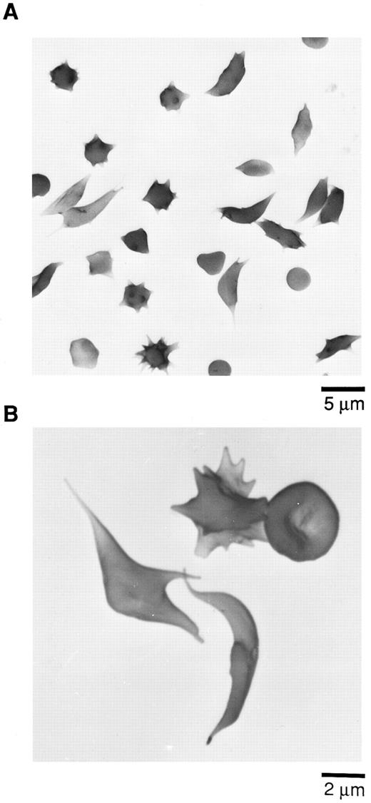 Fig. 3. Scanning electron micrographs (SEM) of sickle cells in blood from Tg58 × Tg98 mice after deoxygenation in 1% Na2S2O5 . Deoxygenated blood was fixed in buffered 2.5% glutaraldehyde and processed for SEM as described in the Materials and Methods. (A) Lower magnification to show the incidence and variety of sickle cells in deoxygenated blood. (B) Higher magnification to show more detail of the various shapes of sickled, multispiculated, and normal shaped RBCs in deoxygenated blood.
