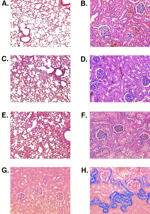Fig. 6. Histologic sections. (A) Lung of an MHOAH mouse showing thin alveolar septa. (B) Kidney of an MHOAH mouse. (C) Lung of an M-Tg58Ru mouse showing congestion and thickening of the alveolar septa. (D) Kidney of an M-Tg58Ru mouse showing RBC congestion in the glomerular tufts and swelling of the capsular epithelium. (E) Lung of a Tg58 × Tg98 mouse showing congestion and thickening of the alveolar septa. (F ) Kidney of a Tg58 × Tg98 mouse showing RBC congestion in the glomerular tufts and swelling of the capsular epithelium. (G) Kidney of an MHOAH mouse stained with Pearl's Prussian blue and counterstained with eosin showing no deposit of stainable iron. (H) Kidney of a Tg58 × Tg98 mouse stained with Pearl's Prussian blue and counterstained with eosin showing that deposits of stainable iron are present in epithelial cells of Bowman's capsule and proximal tubules. (Original magnification × 100 for lung and × 200 for kidney.)