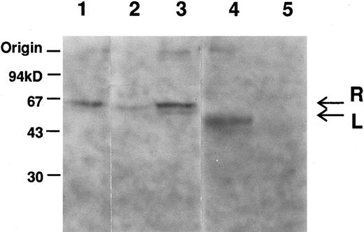 Fig. 1. Immunoblot analysis of erythrocytes and liver extracts with anti-L–PK. Labeled bands, which migrated at positions corresponding to about 62 (arrow designated as R) and 60 (arrow designated as L) kD, were R-and L-PK, respectively. Lane 1, normal erythrocytes; lane 2, low density fraction of erythrocytes of PK Kowloon; lane 3, unfractionated erythrocytes of PK Kowloon; lane 4, normal liver; lane 5, liver of PK Kowloon.
